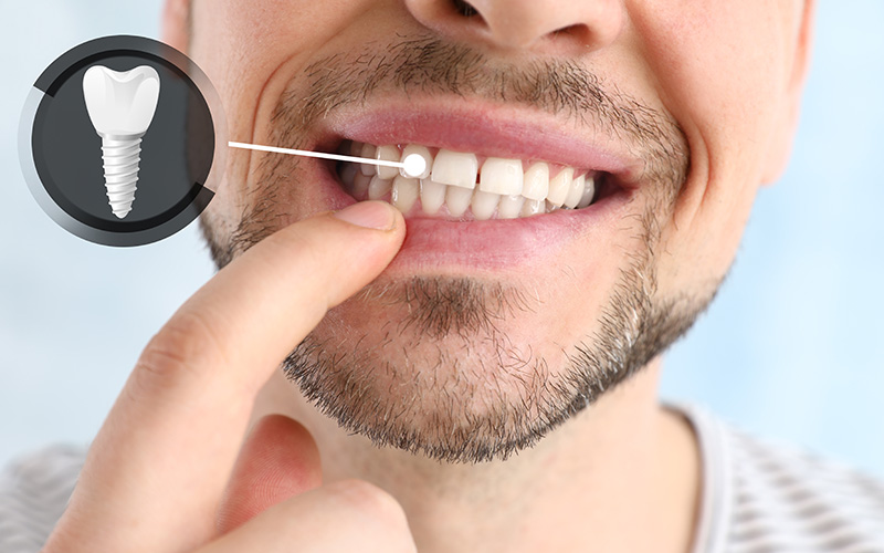 JASI Smile | General Dentistry, Inlays  amp  Onlays and Cosmetic Dentistry