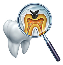 JASI Smile | Invisalign reg , Zirconia Crowns and Implant Dentistry