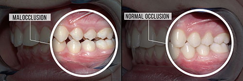 JASI Smile | Cosmetic Dentistry, Ceramic Crowns and Veneers