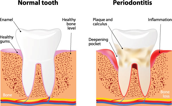 JASI Smile | Implant Dentistry, Veneers and Invisalign reg 