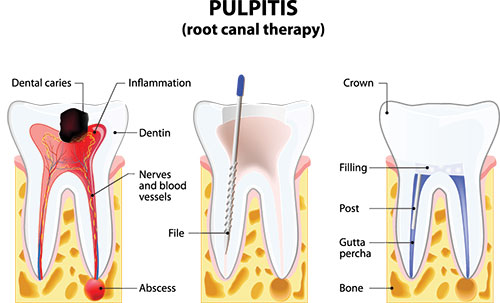 JASI Smile | General Dentistry, Ceramic Crowns and Implant Dentistry