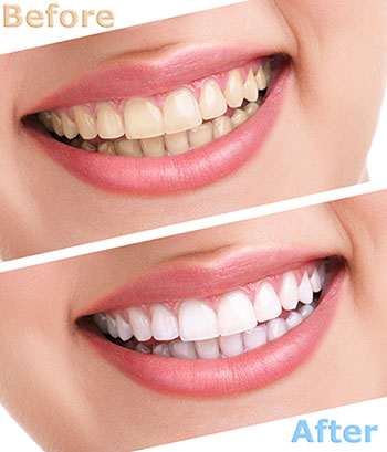 JASI Smile | Botox reg , General Dentistry and ClearCorrect reg 