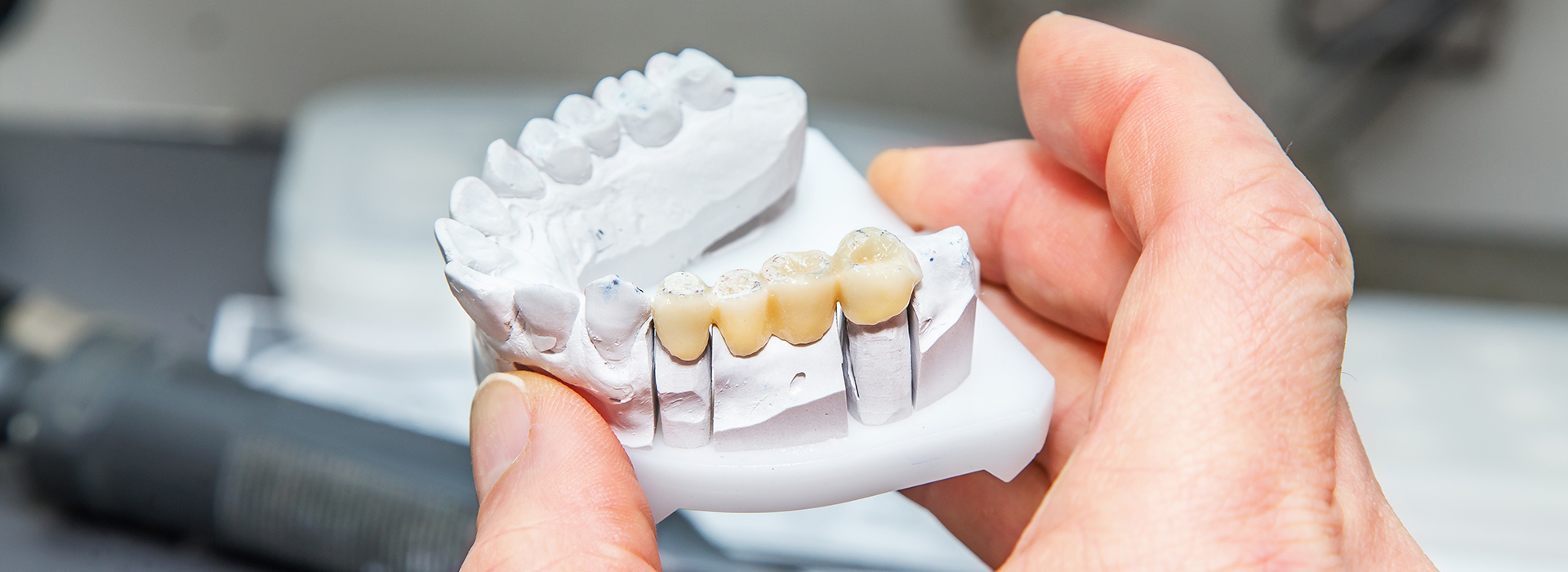 JASI Smile | Botox reg , Juvederm reg  and Implant Dentistry