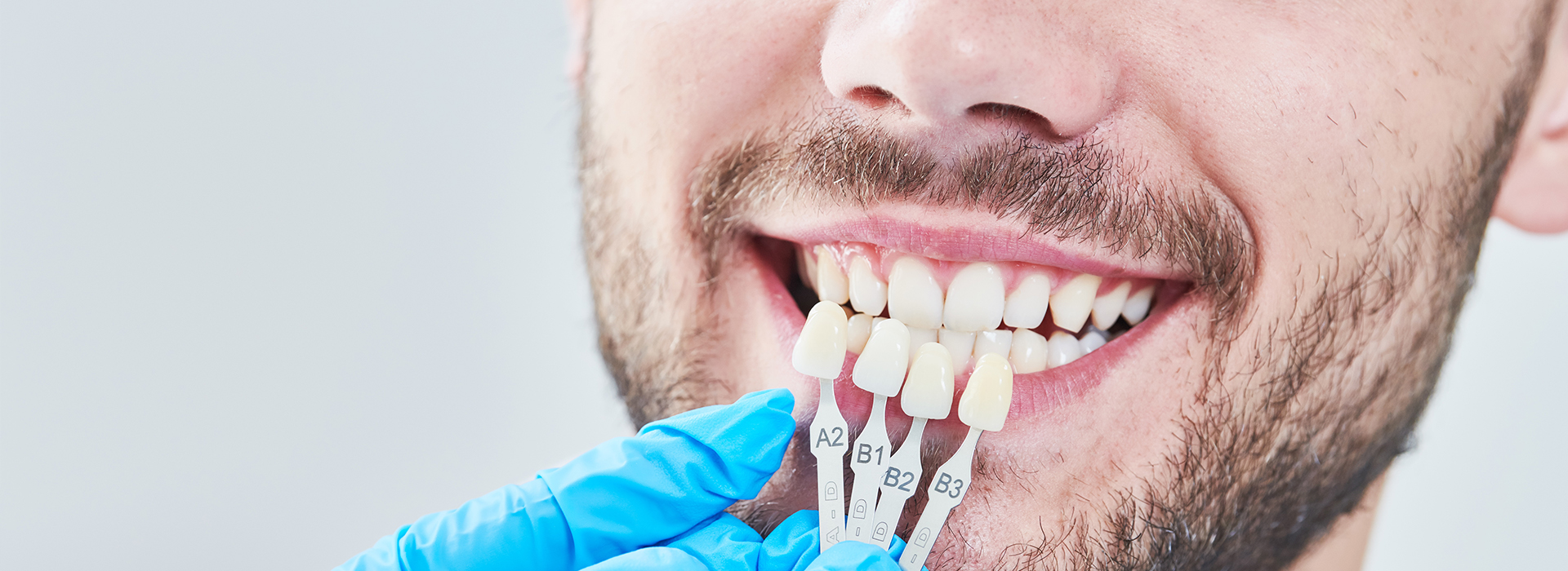 JASI Smile | Invisalign reg , Inlays  amp  Onlays and Clear Aligners